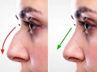 Choosing the Right Specialist for a Nose Job in Dubai