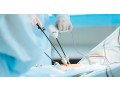 guide-to-finding-the-best-laparoscopic-gynecologist-in-dubai-small-0