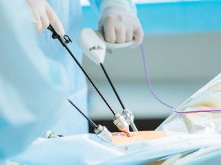 Guide to Finding the Best Laparoscopic Gynecologist in Dubai