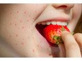 identifying-food-reactions-with-a-test-in-dubai-clinics-small-0