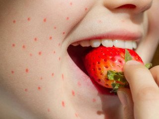 Identifying Food Reactions with a Test in Dubai Clinics