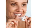 invisalign-dubai-discreet-way-to-straighten-your-smile-small-0