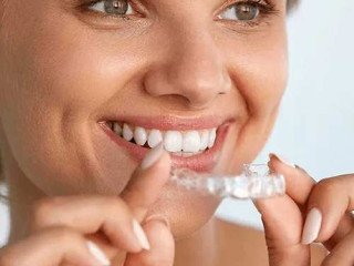 Invisalign Dubai: Discreet Way to Straighten Your Smile