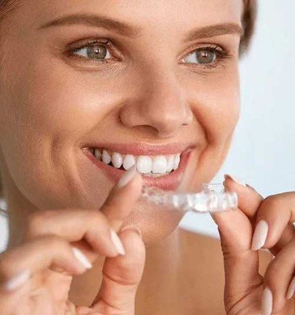 invisalign-dubai-discreet-way-to-straighten-your-smile-big-0