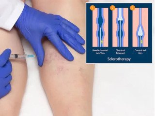 Endovascular Surgeon in Dubai: Conditions, Care, Expertise