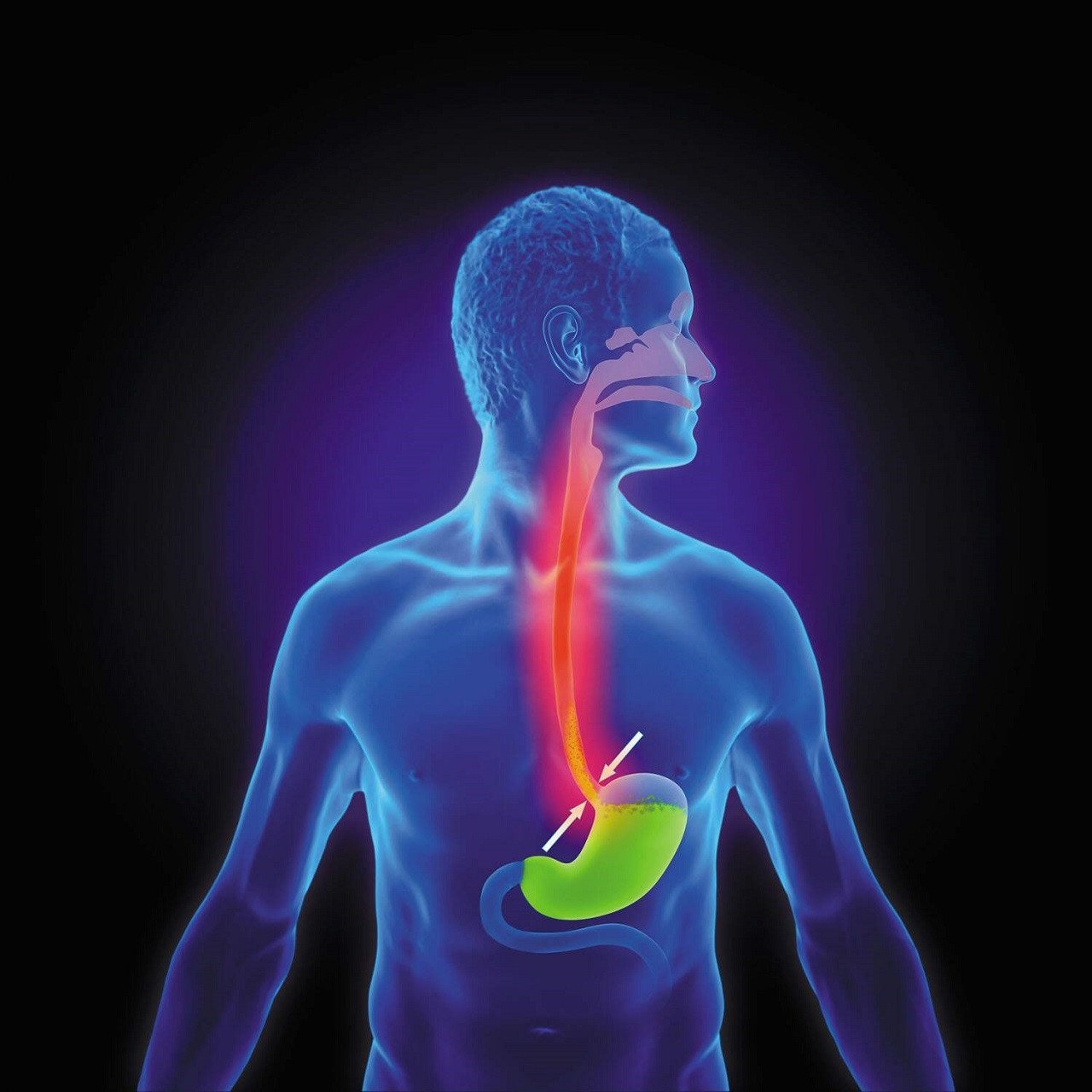 understanding-heartburn-and-its-treatment-options-in-dubai-big-0