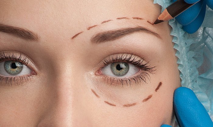 eyelid-lift-surgery-windsor-book-blepharoplasty-consultation-in-ealing-big-0