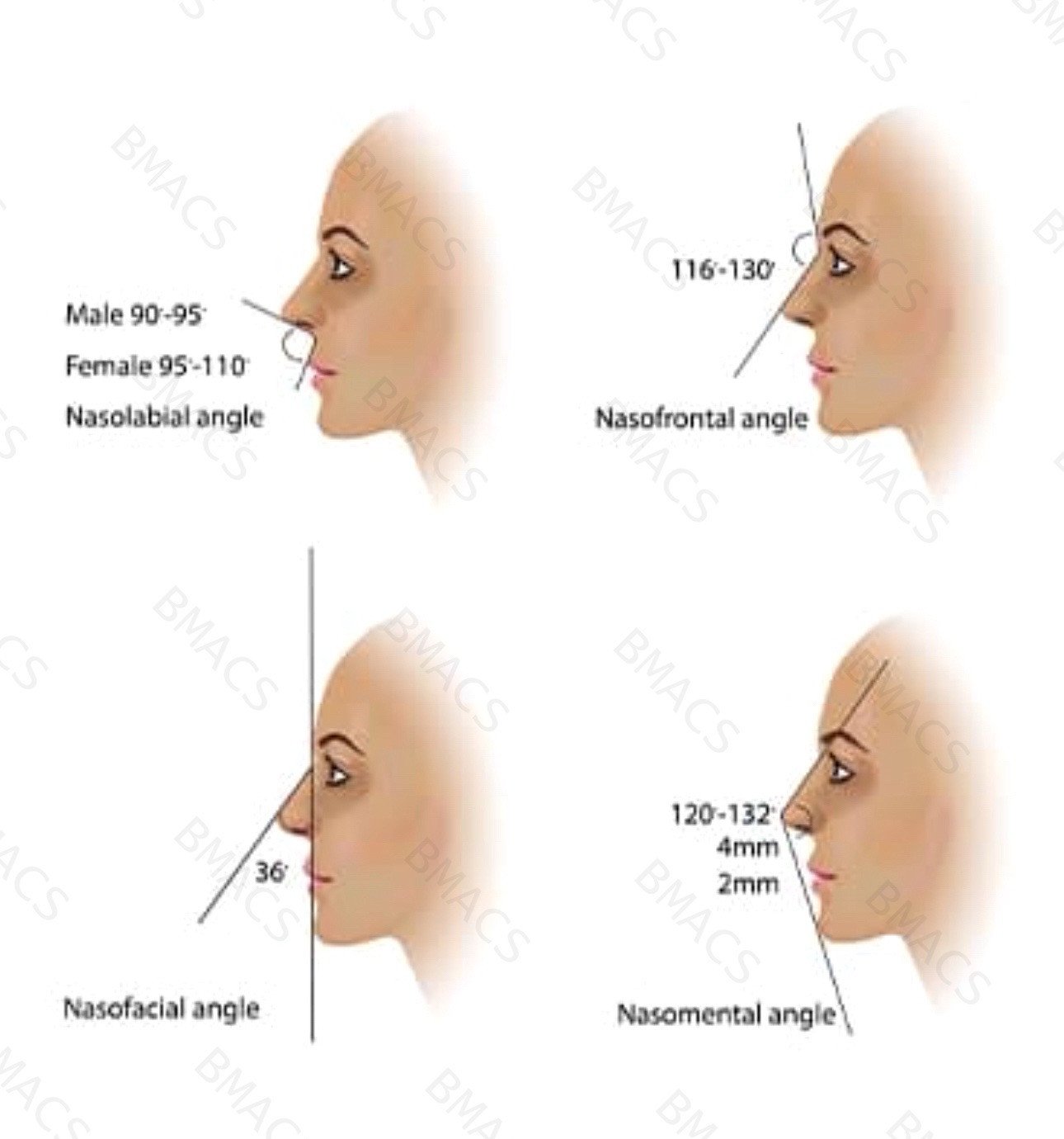 non-surgical-nose-reshaping-in-chiswick-quick-painless-treatment