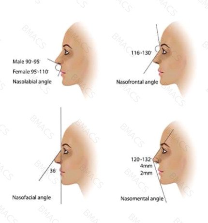 non-surgical-nose-reshaping-in-chiswick-quick-painless-treatment-big-0