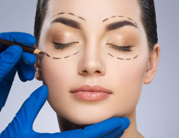 eyelid-surgery-in-windsor-bmacs-big-0