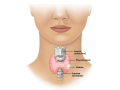 pediatric-hypothyroidism-treatment-in-coimbatore-best-hospital-for-thyroid-surgery-in-coimbatore-small-0