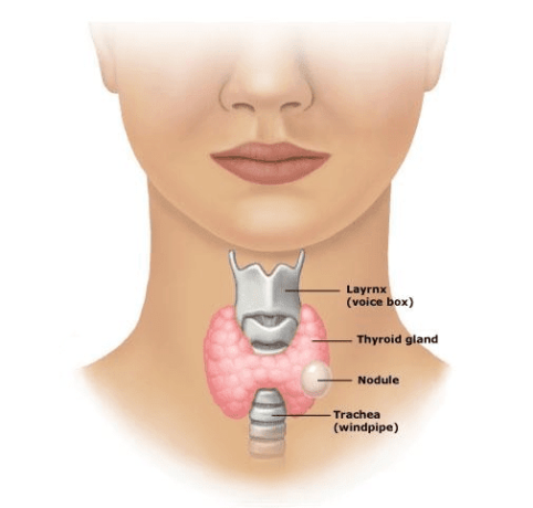 pediatric-hypothyroidism-treatment-in-coimbatore-best-hospital-for-thyroid-surgery-in-coimbatore-big-0