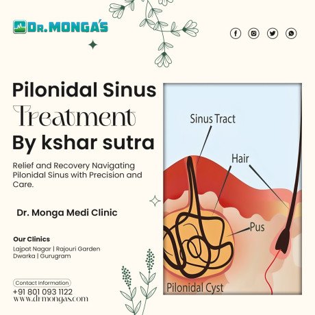 best-pilonidal-sinus-treatment-in-fatehpur-beri-8010931122-big-0