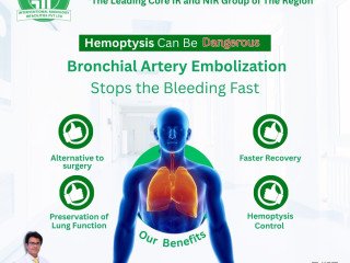 Minimally Invasive Bronchial Artery Embolization