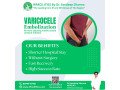 advanced-varicocele-embolization-treatment-for-fast-recovery-small-0