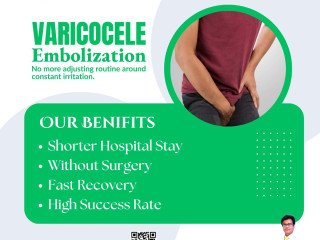 Advanced Varicocele Embolization Treatment for Fast Recovery