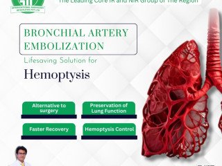 Affordable Bronchial Artery Embolization in India