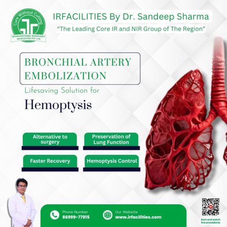 affordable-bronchial-artery-embolization-in-india-big-0