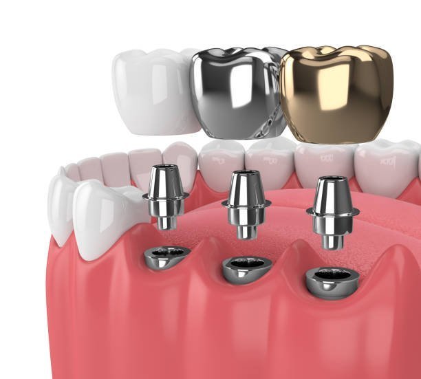 best-dentistry-near-me-big-0