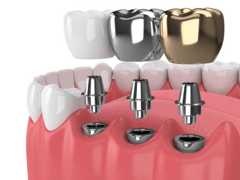 best-dentistry-near-me-small-0