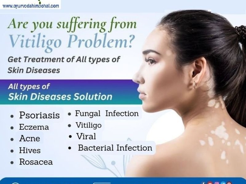 arogyam-pure-herbs-kit-for-vitiligo