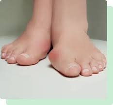 bunion-specialist-south-amboy-big-0